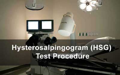 Hysterosalpingogram (HSG) Test Procedure